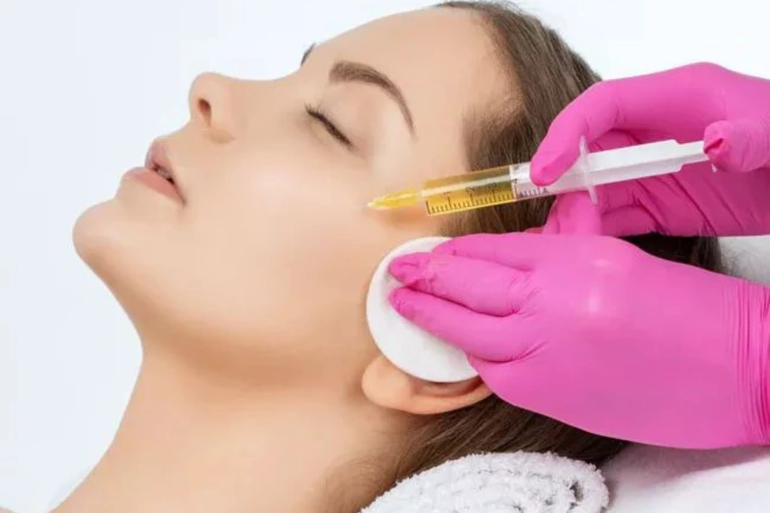Face PRP Treatment