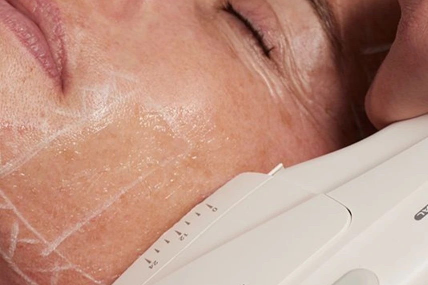 HIFU Treatments